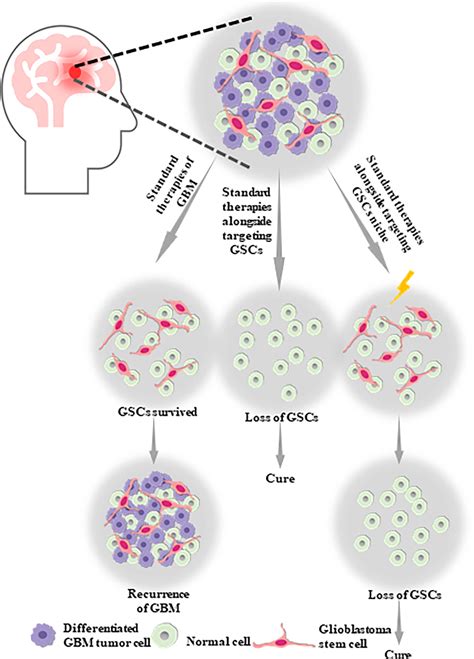 glioblastoma cancer stem cells